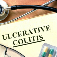 10 Effective Tips for Managing Ulcerative Colitis