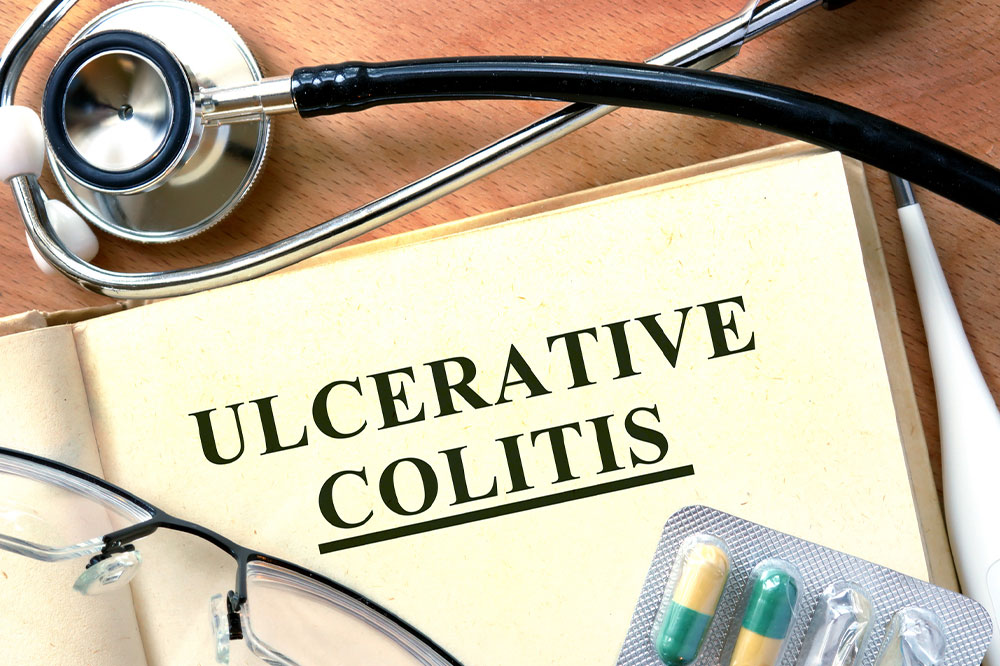 10 Effective Tips for Managing Ulcerative Colitis