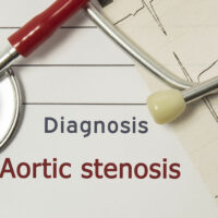 14 ways to prevent and manage aortic stenosis