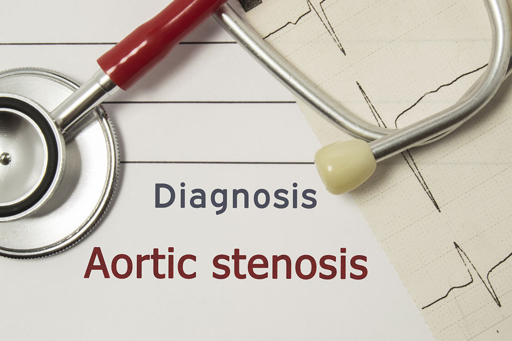 14 ways to prevent and manage aortic stenosis