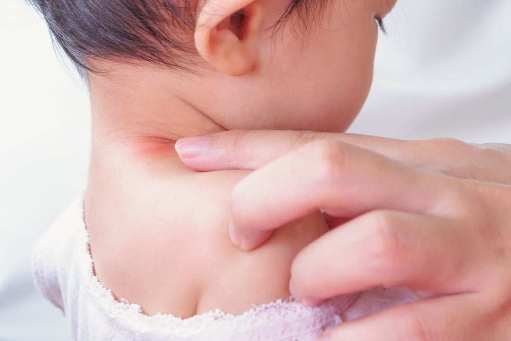 17 soap ingredients that could trigger eczema in kids