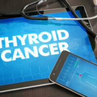 6 Silent Signs of Thyroid Cancer