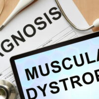 9 common types of muscular dystrophy and their symptoms