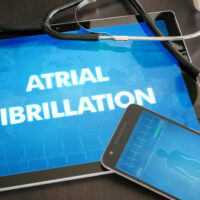 Atrial Fibrillation &#8211; Causes, Signs, and Remedies