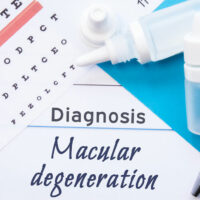 Macular Degeneration &#8211; Causes, Symptoms, and More