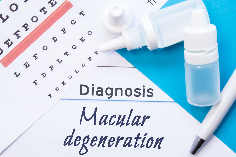 Macular Degeneration &#8211; Causes, Symptoms, and More