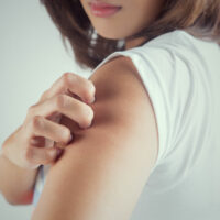 Must-know Triggers of Itchy Skin