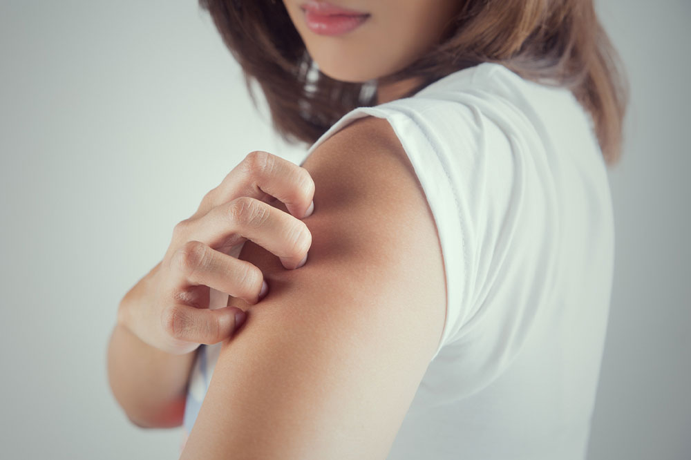 Must-know Triggers of Itchy Skin