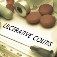 Signs and complications of ulcerative colitis