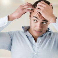 5 key things to know about hair transplants